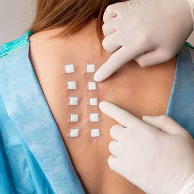 Patch-Test-e-Prick-Test-Poliambulatorio-F-Medical-Ferrara